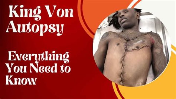Tragic Autopsy Findings Reveal Dayvon Bennett's Untimely Demise