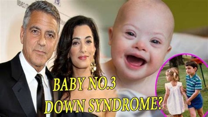 Unveiling The Truth: Does George Clooney's Son Possess Down Syndrome?