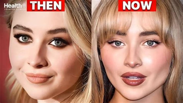 Unveiling The Truth: Has Sabrina Carpenter Had Plastic Surgery?